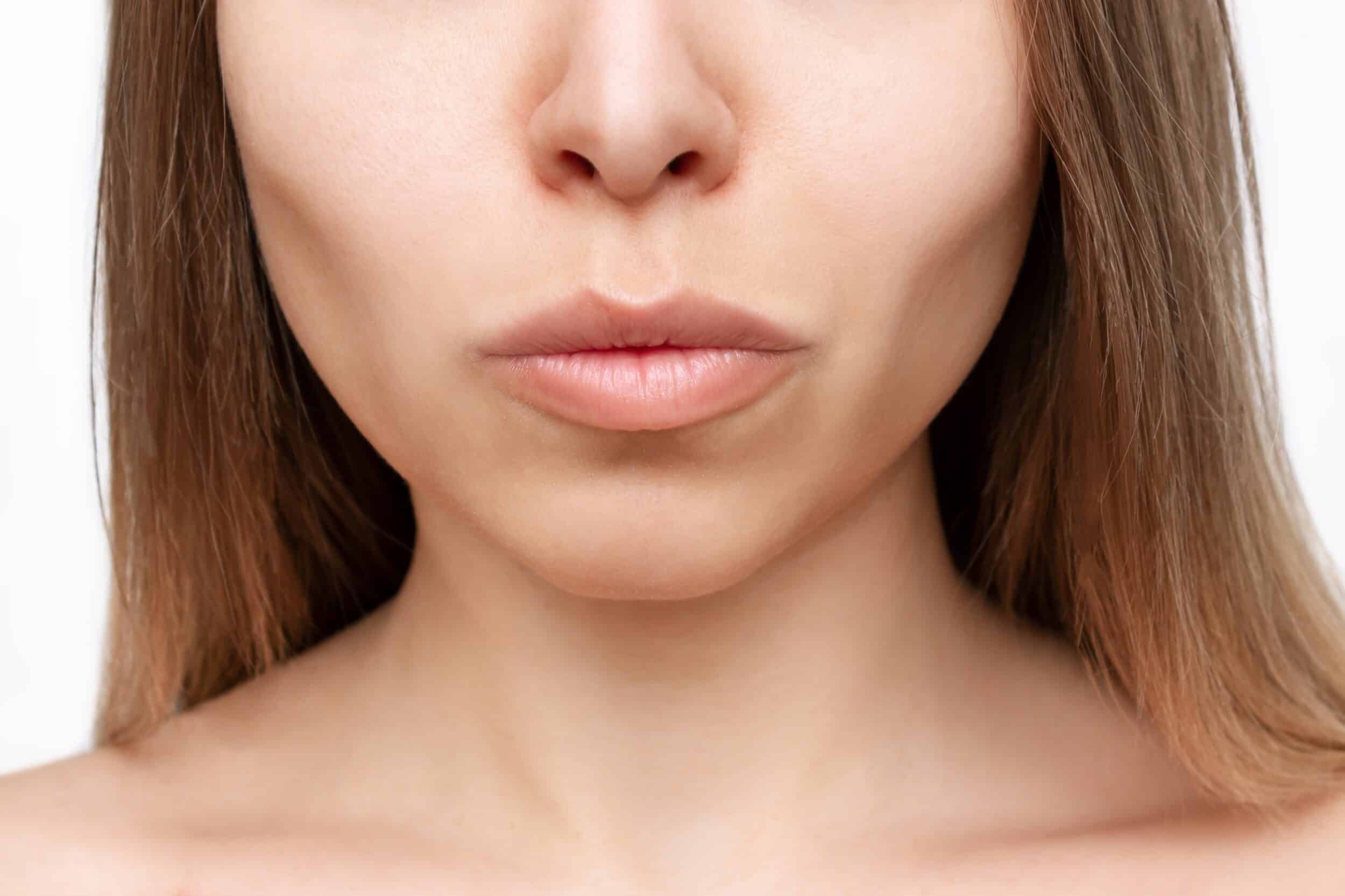 A cropped shot of a woman with sculpted cheekbones from buccal fat removal